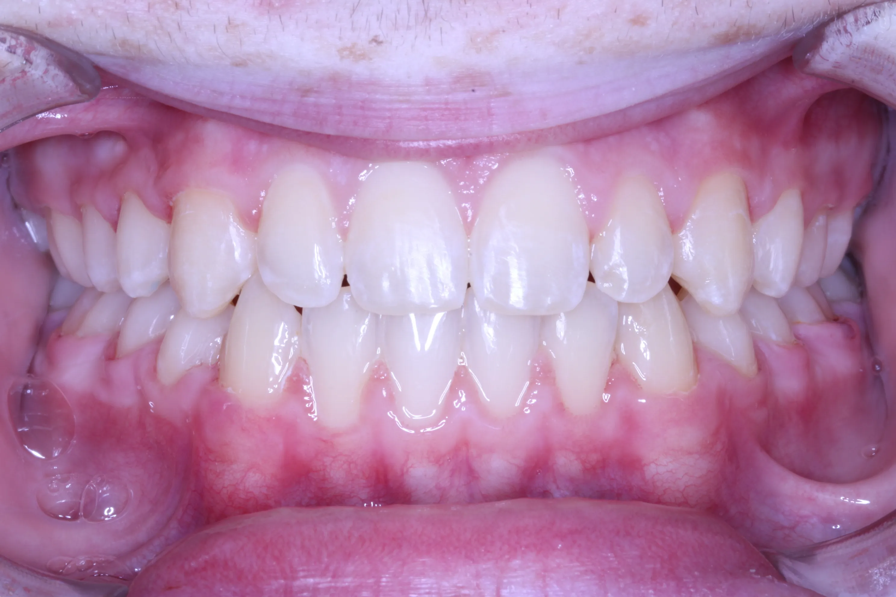 smile-gallery gallery